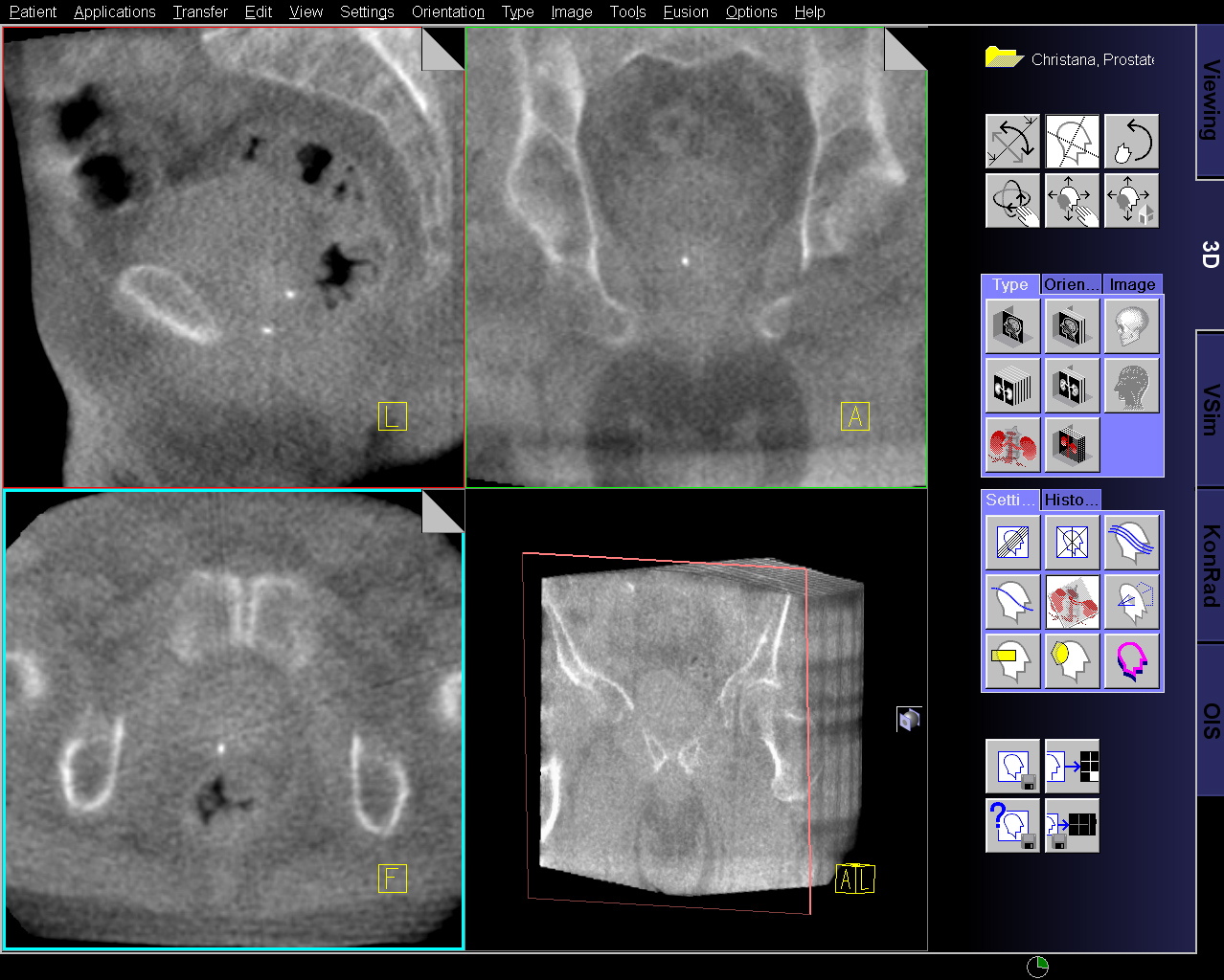 New Testing for Prostate Cancer Offered at New